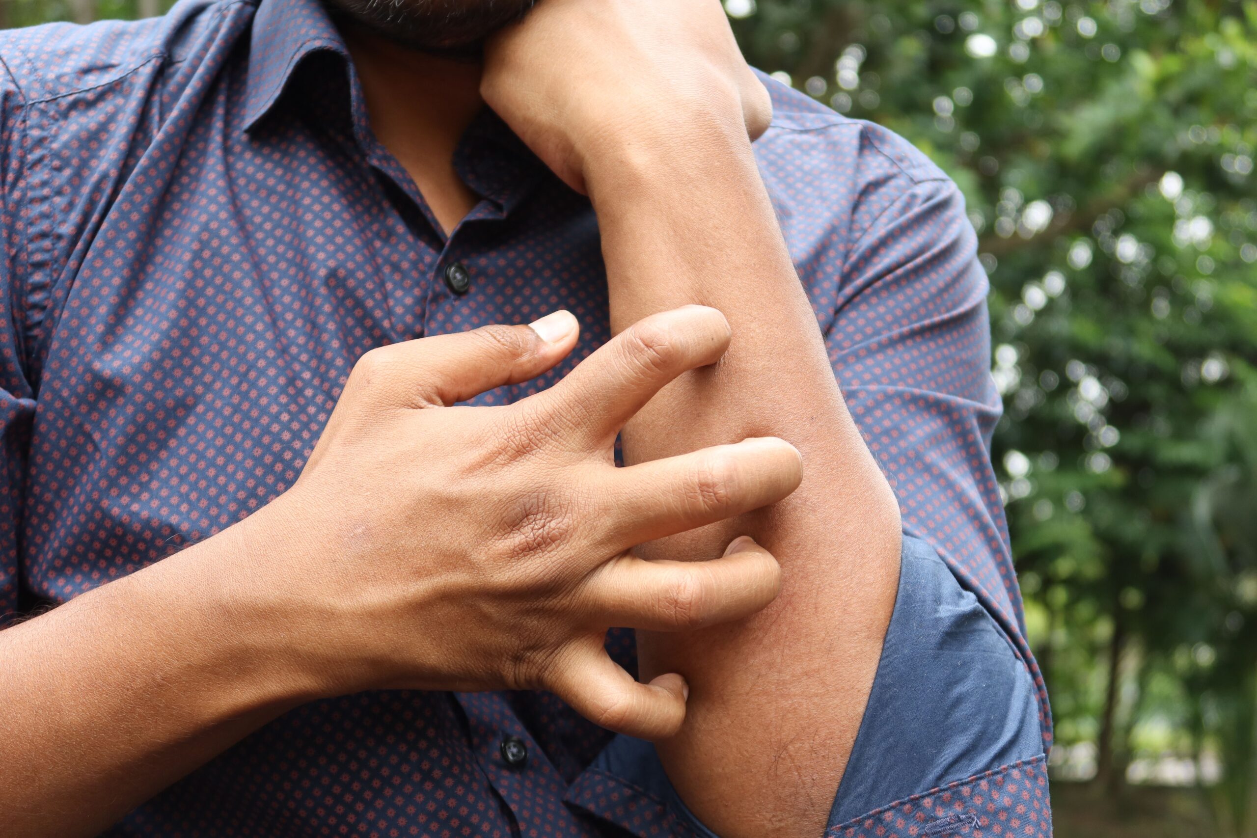 L’orticaria e gli extraprofitti